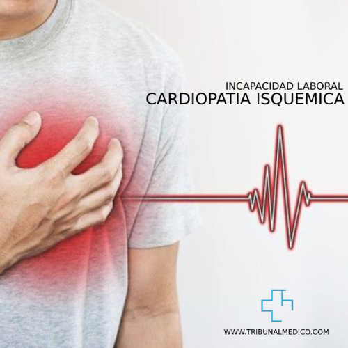 Incapacidad Laboral por cardiopatía isquémica