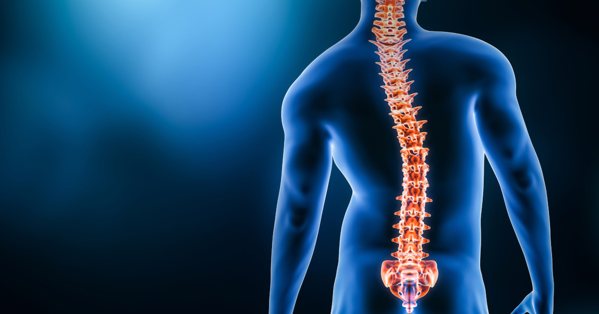 Incapacidad por escoliosis