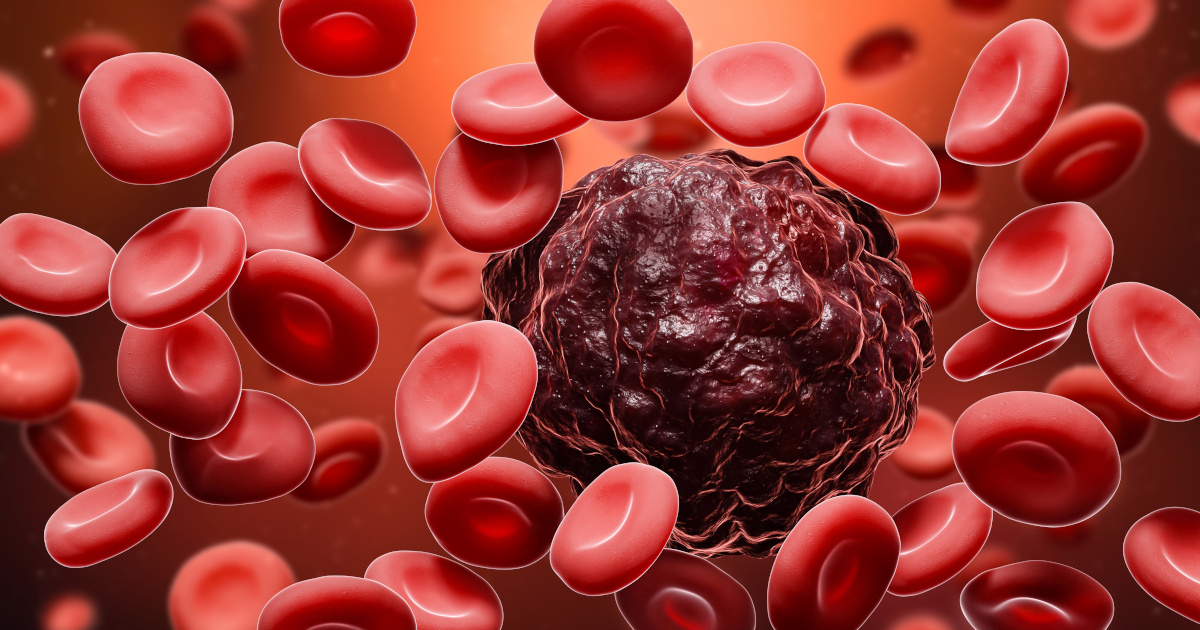 Incapacidad por leucemia